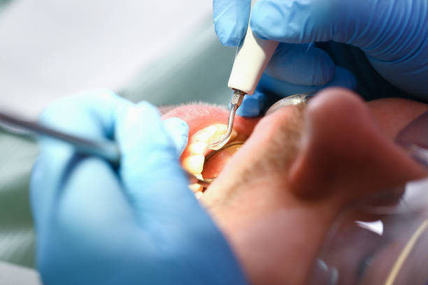 Best After-Hours Emergency Dentist in Lipatria, CA