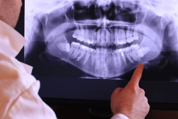Best Emergency Treatment for Toothache in Lipatria, CA