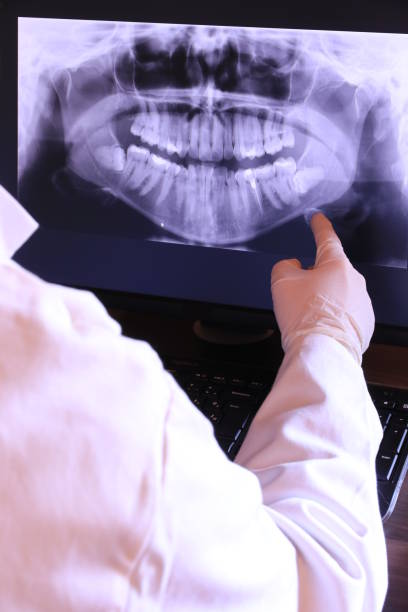 Best Walk-In Emergency Dentist in Lipatria, CA
