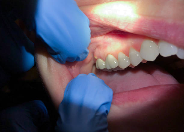 Best Emergency Dental Surgery in Lipatria, CA