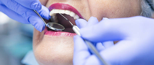 Best Emergency Broken Tooth Repair in Lipatria, CA
