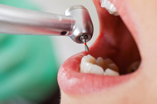 Best Emergency Dental Surgery in Lipatria, CA